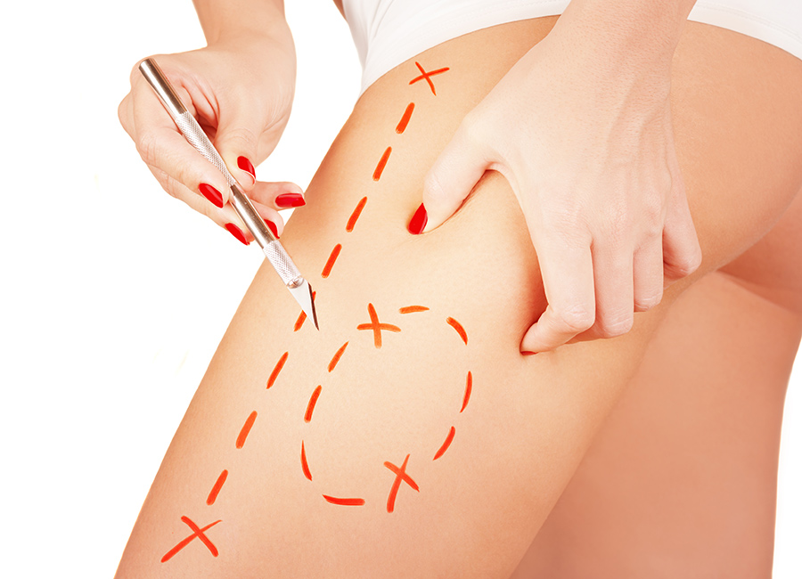 Aisling O'Loughlin: How plastic surgery became the new normal for Irish women...