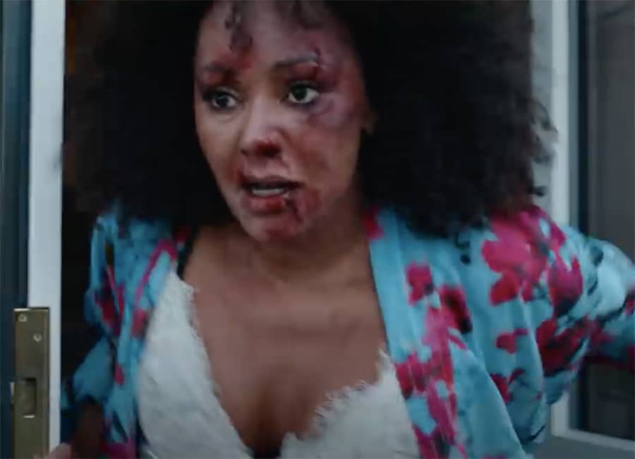 WATCH: Mel B appears in shocking domestic abuse awareness video