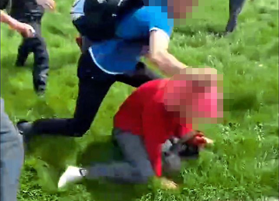 Schoolboy suffers facial injuries in sickening attack by fellow students in Navan