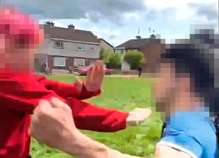 Schoolboy suffers serious facial injuries in sickening attack by fellow students